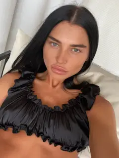 Albinos Escort in Berlin